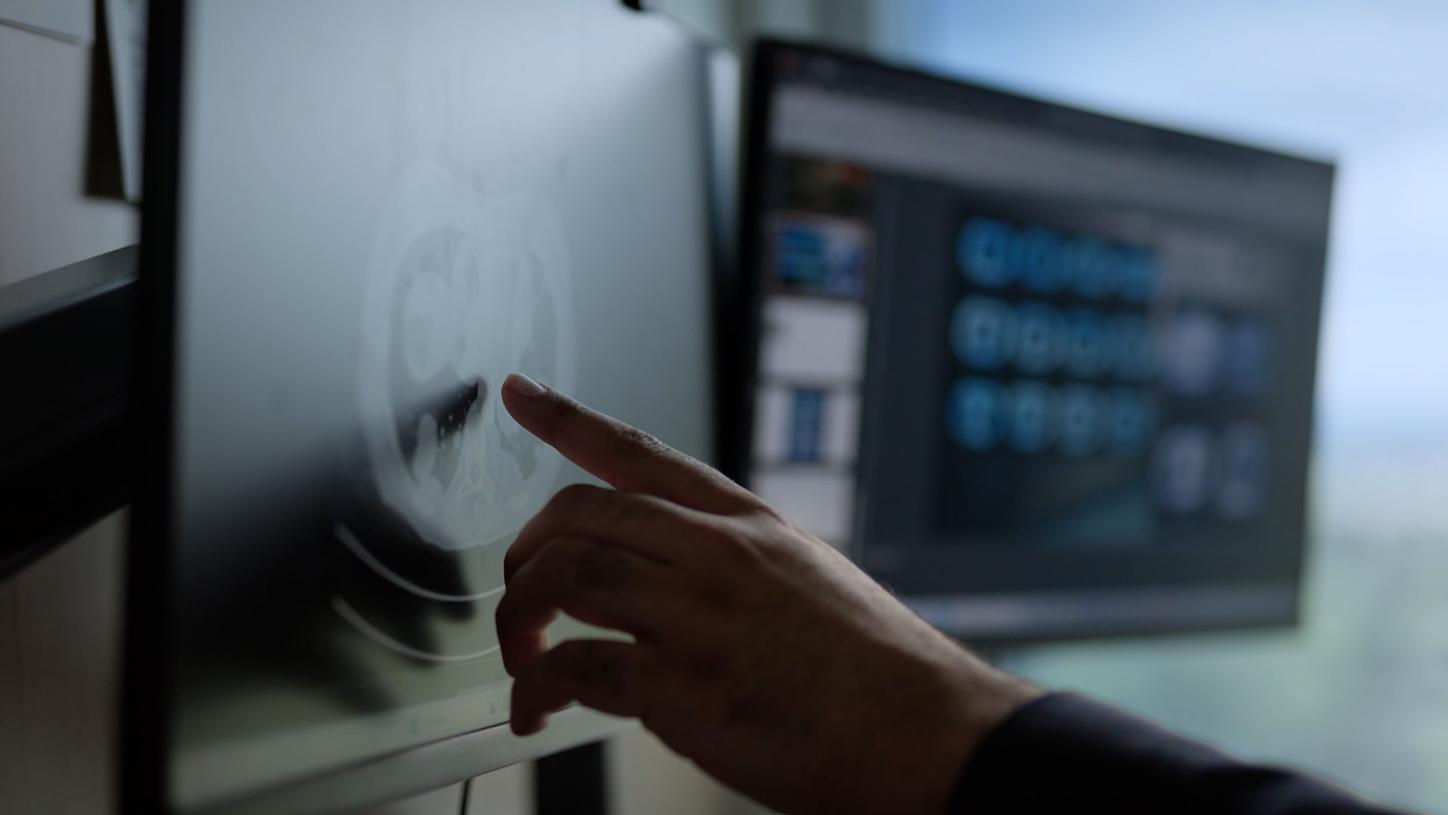 Omar Khan, MD, Medical Oncologist at Cancer Care Alberta, Canada, pointing at a clinical image