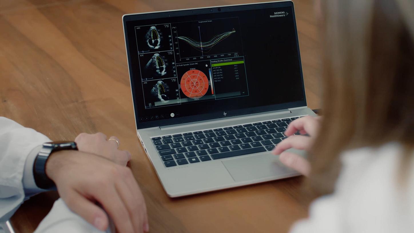 Clinicians looking at a laptop screen. It shows several clinical images and graphs to monitor cardiotoxicity in a cancer patient.