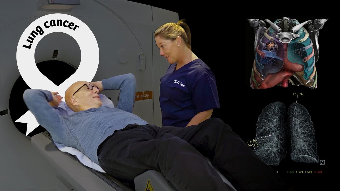 Photo collage of a lung cancer screening with clinical images