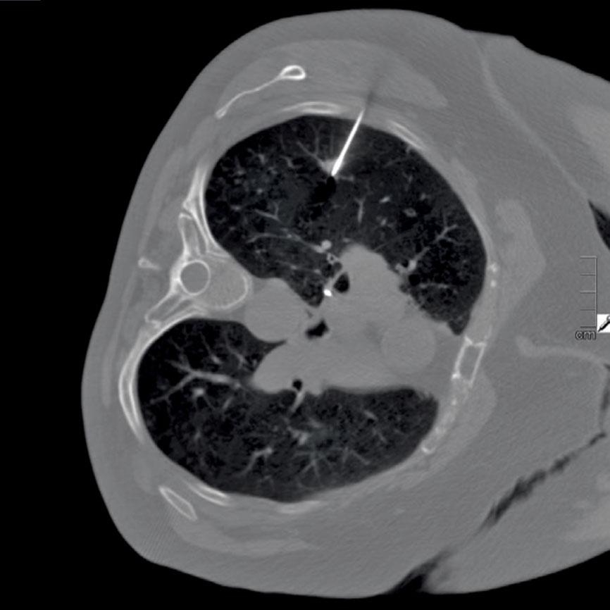 A German hospital is keeping X-ray doses as low as reasonably achievable with the help of Siemens teamplay.