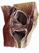 At RSNA 2017 Siemens Healthineers is addressing the most frequent MRI examiniation, imaging the knee, with the GOKnee3D application.
