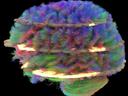 MRI application Simultaneous Multi-Slice
