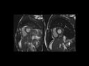 Faster MRI scans with Compressed Sensing from Siemens Healthineers