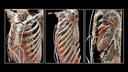 The photorealistic representation is closer to the real-life surgical view than other imaging representation methods.