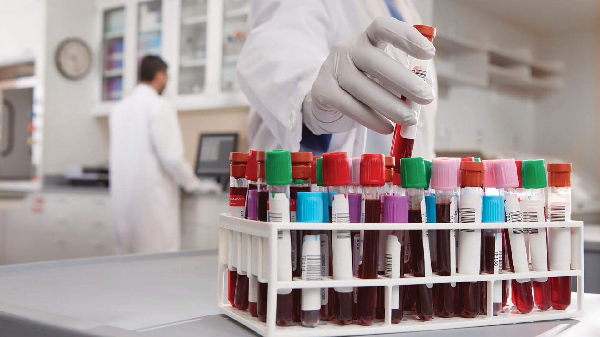 HighSensitivity Troponin I Assays Quicker RuleOut,1 Safer RuleIn