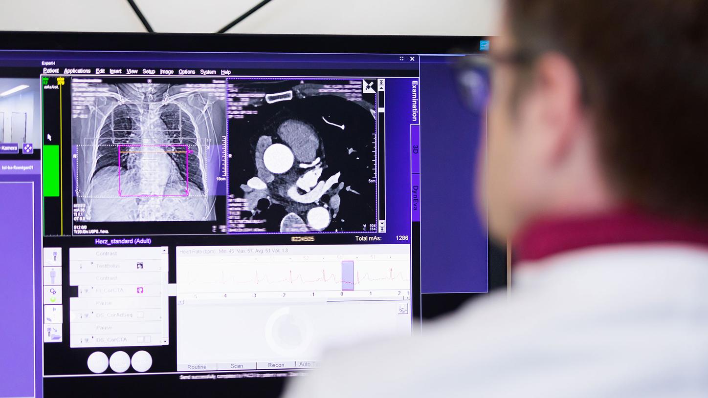 J&uuml;rgen Fornaro, MD looks at a heart CT scan on a screen.