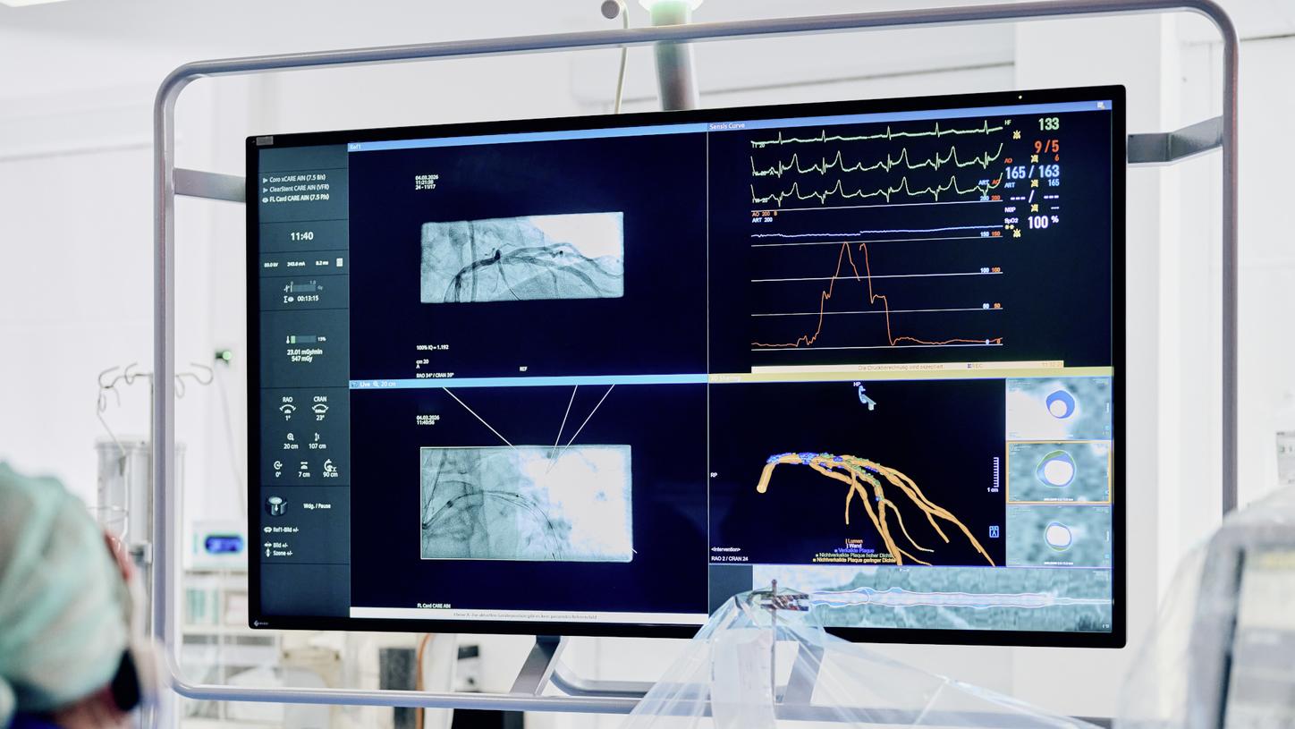 Siemens Healthineers introduces industry-first seamlessly integrated end-to-end solution for CT-guided percutaneous coronary interventions 