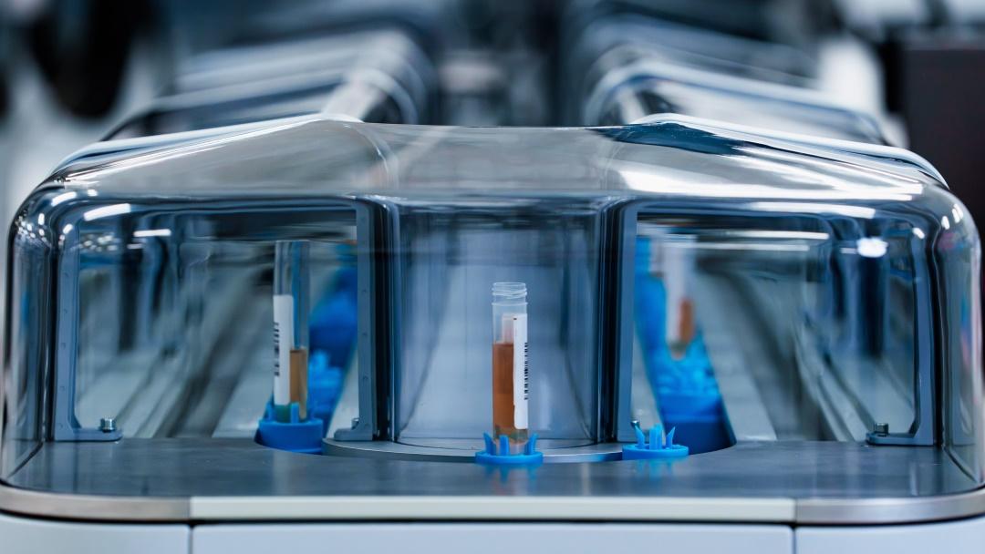 Blutproben fahren auf der Automatisierungsspur im Labor.