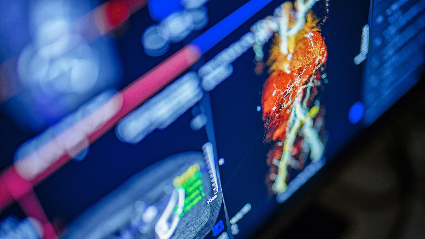 Screen showing clinical CT-image