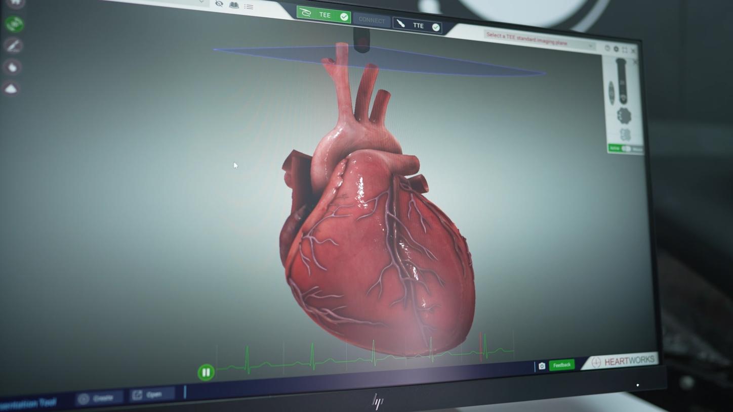 Anatomical image of a human heart on a computer screen.