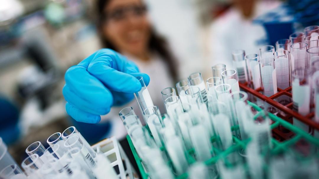 Nahaufnahme von Küvetten. Eine Kollegin im Hintergrund greift nach einer von ihnen.