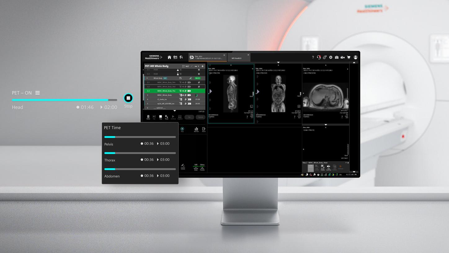 Klinische Arbeitsstation, die PET-Scan-Bilder, Untersuchungszeitpläne und bildgebende Kontrollen anzeigt, mit einem im Hintergrund sichtbaren PET-Scanner.