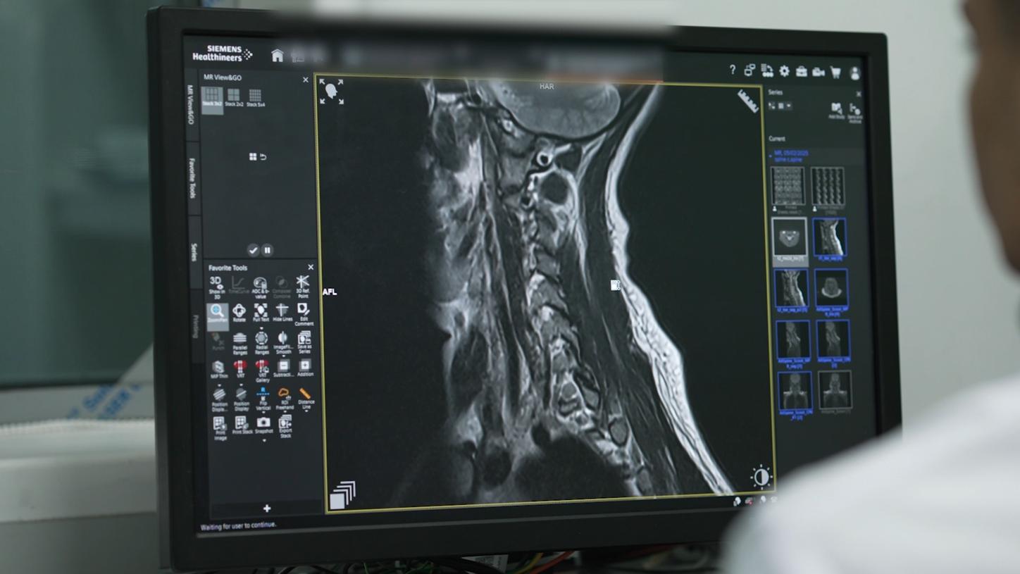 MRI image on a computer screen