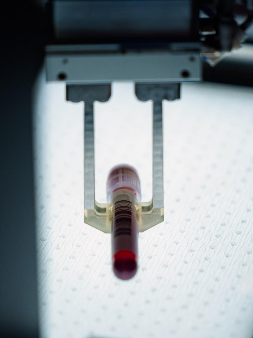 Die Blutprobe wird von einem Roboter aufgehoben.