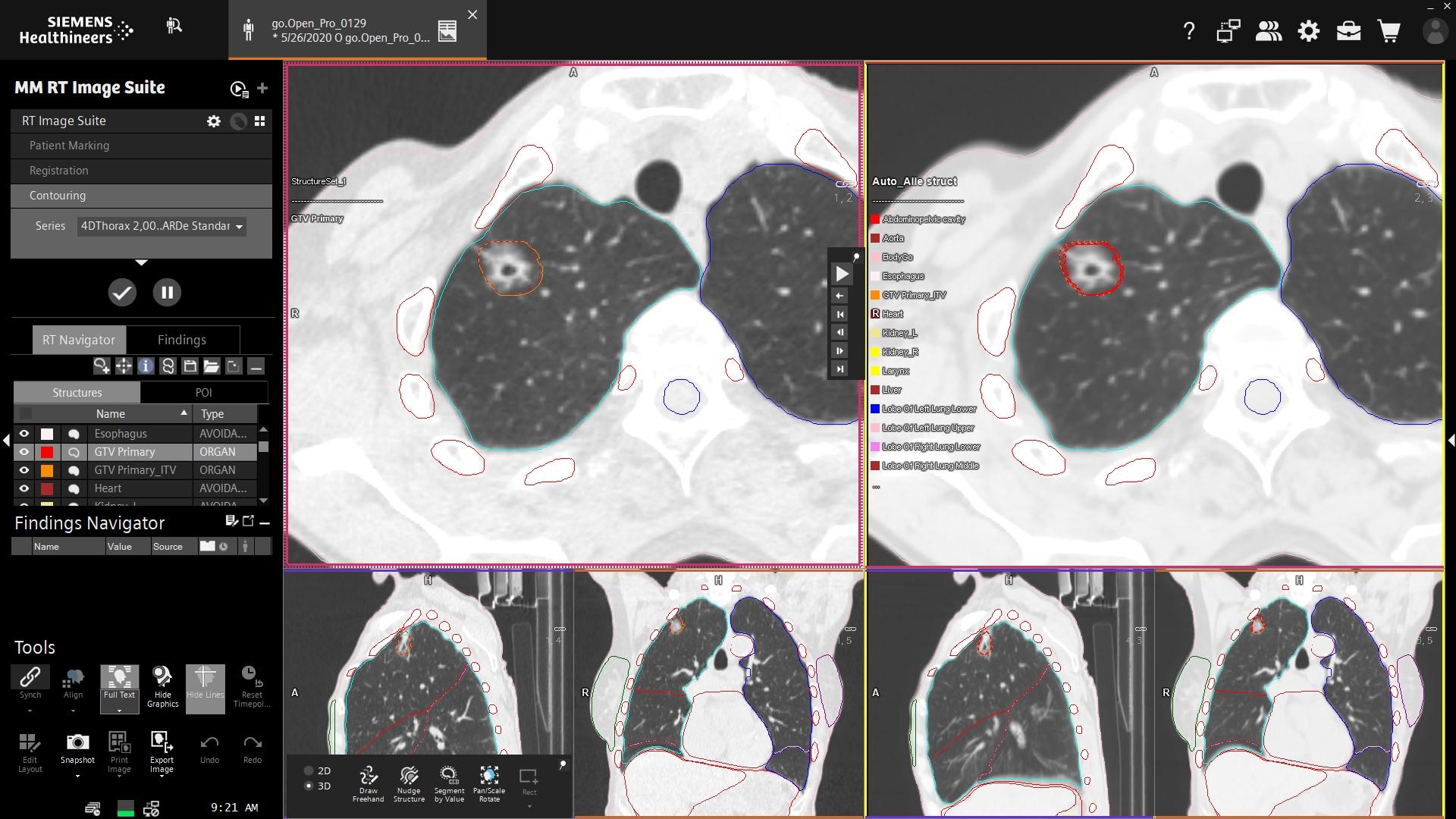 Searching for the causes of cancer