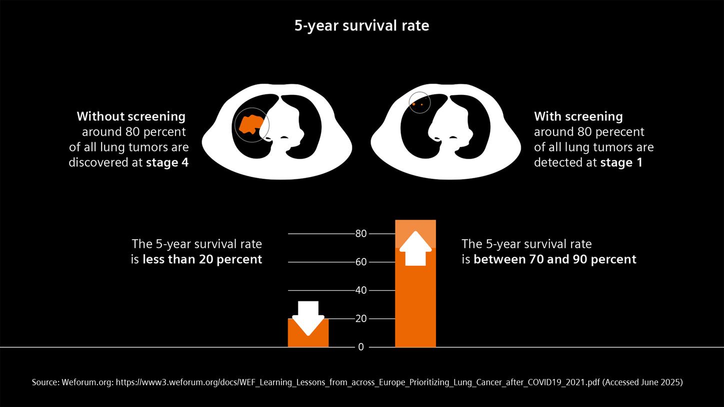 Lung Cancer Screening Stage Shift