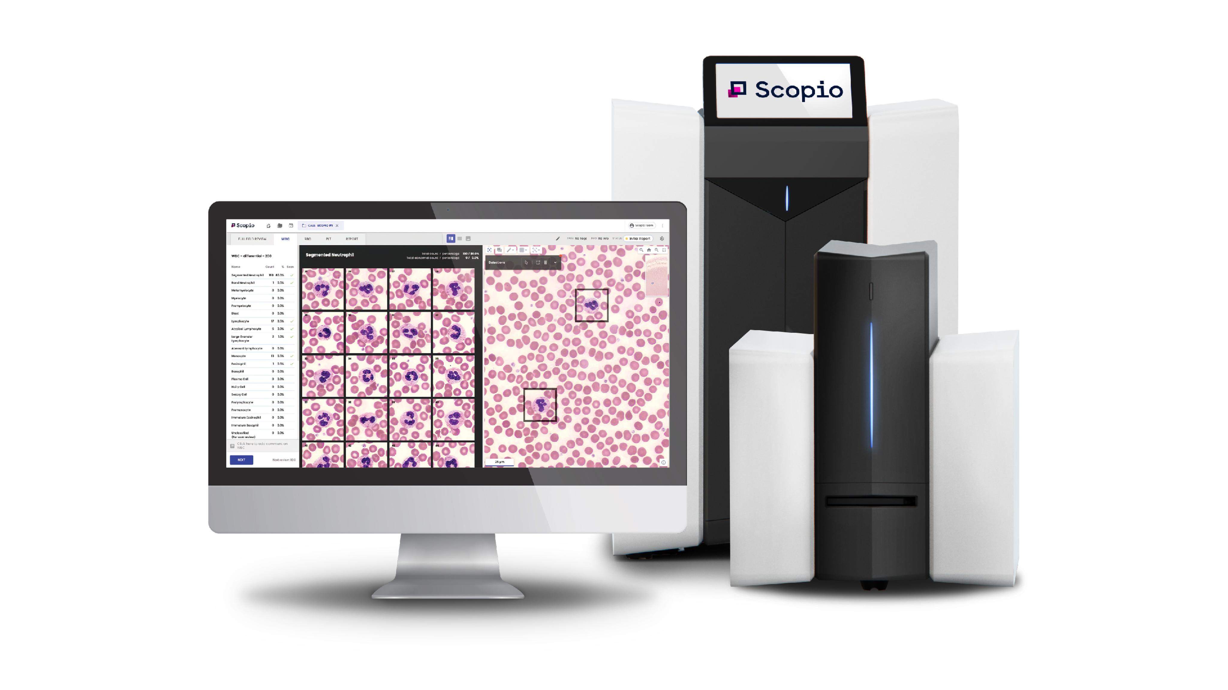 Siemens Healthineers Enters into Agreement with Scopio Labs to