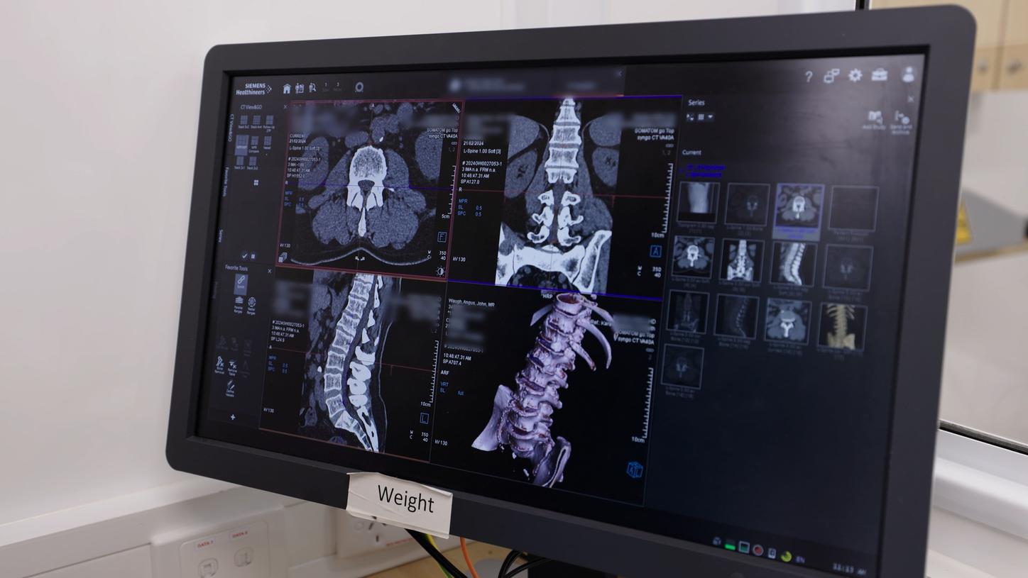 A computer screen showing several clinical images of a CT scan.