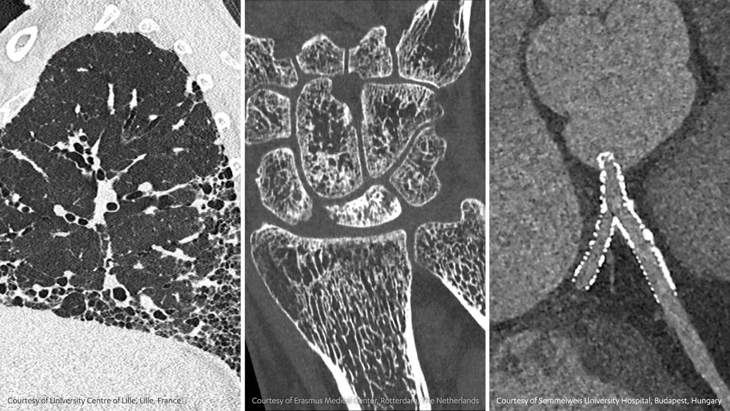 Ccot Radiographic The future of computed tomography