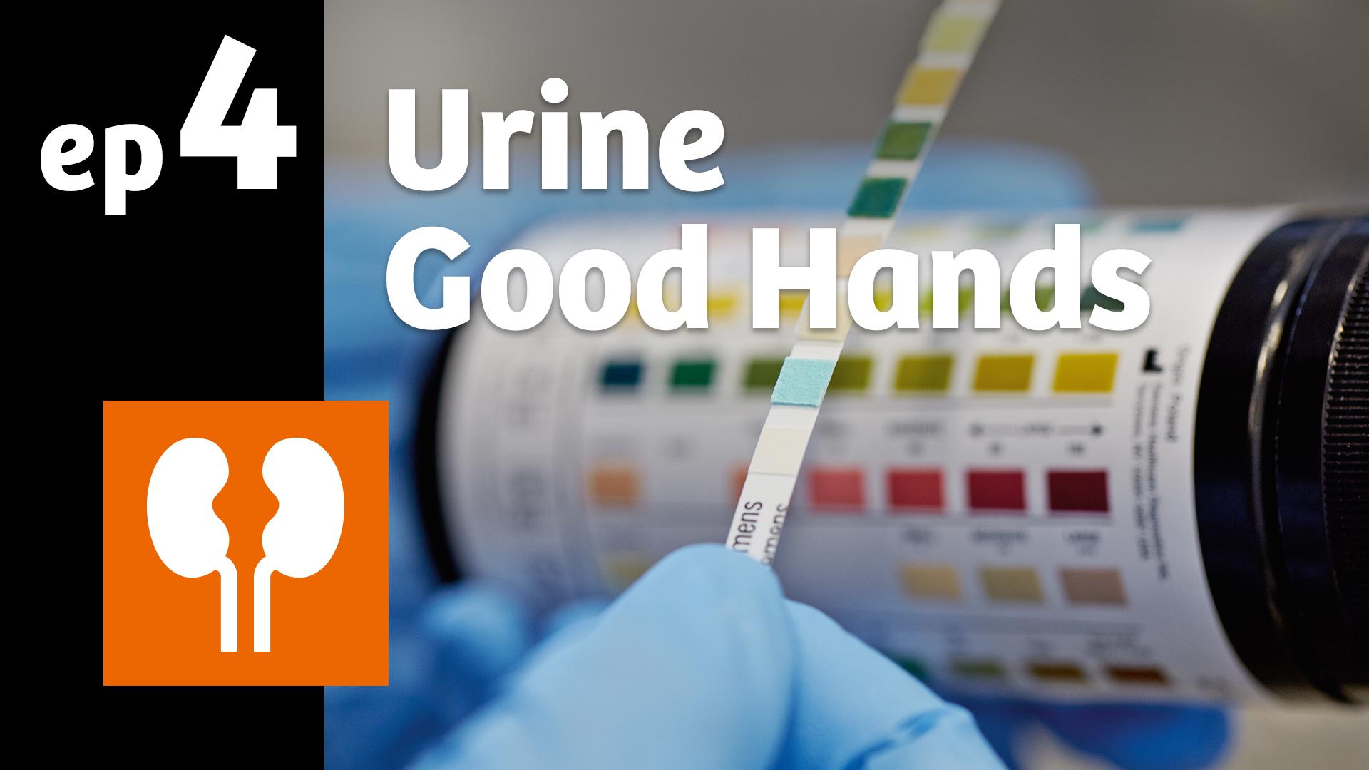 Urinalysis A wealth of information in just a few drops